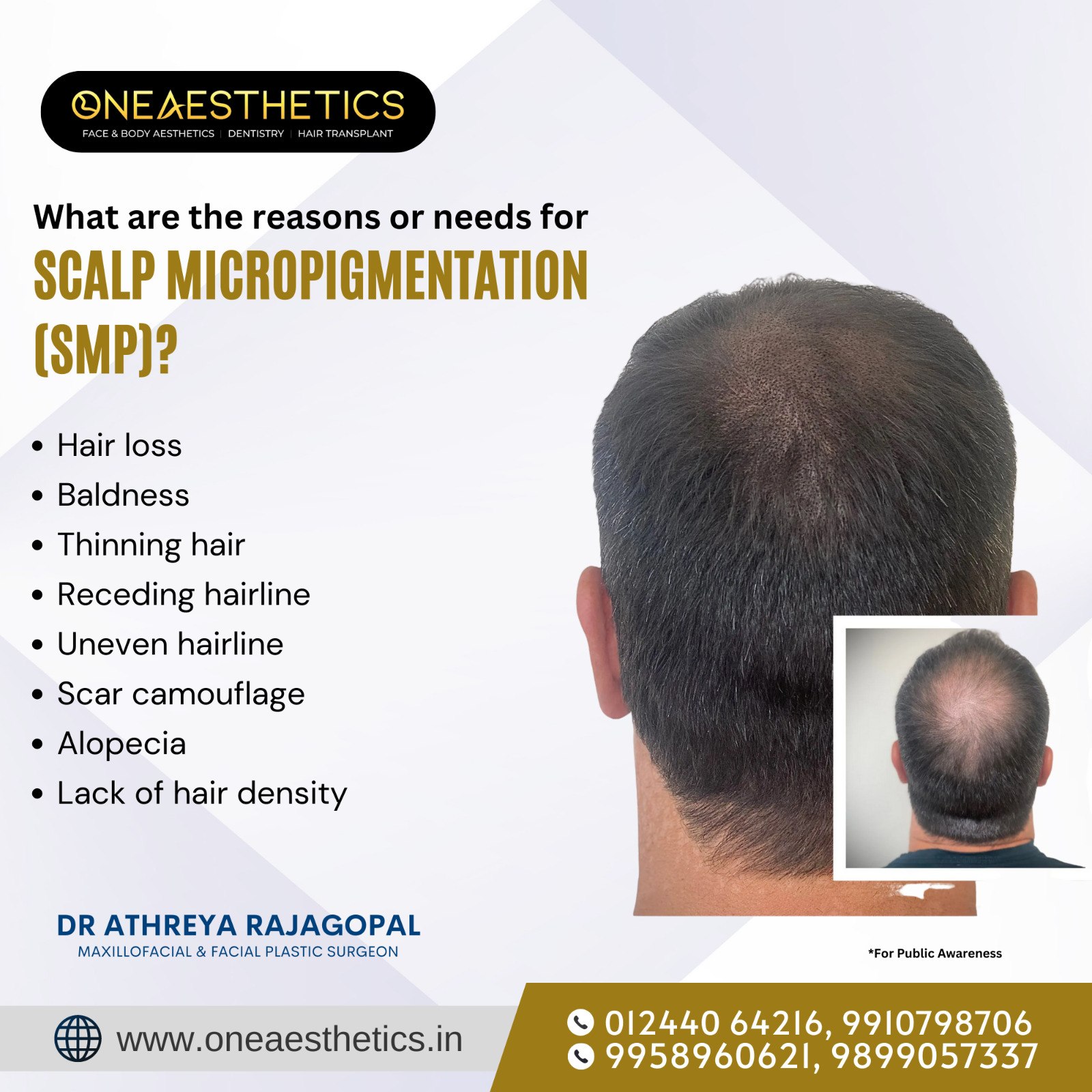 Hair Transplant Surgeon Delhi - Oneaesthetics